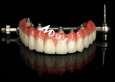 China Customized Shape Dental Implant Crown Bridge For Missing Teeth Maintenance for sale