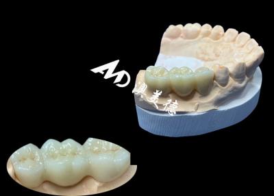 중국 천연 색의 지르코니아 치아 왕관 China Dental Lab의 흠없는 미소를 위해 균열 저항 판매용