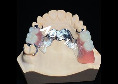 China Dentadura extraíble con marco de metal fundido para una resistencia y estabilidad superiores con una comodidad duradera en venta