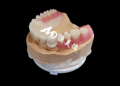 China Dentadura parcial removível acrílica para dentes ausentes à venda