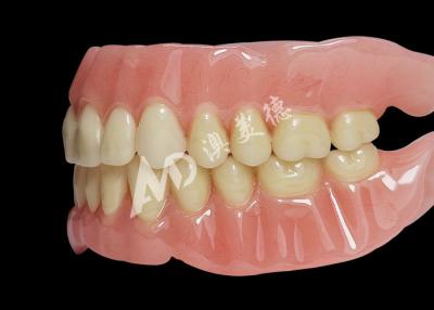 China Long Lasting Durability Removable Denture With Comfortable And Stable Fit for sale