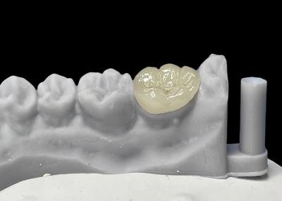 China Accurate Fit Dental Ceramic Inlays Onlays , Porcelain Inlays And Onlays FDA Approved for sale