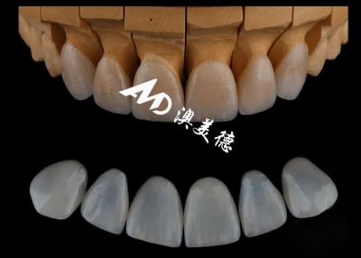 China Highly Accurate Customized Emax  Veneers/porcelain Dental Veneer For Cosmetric Dentistry for sale