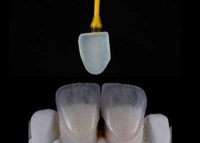 China Custom Made Dental Restoration EMAX Veneers Beautifully Aligned Digital Impression for sale