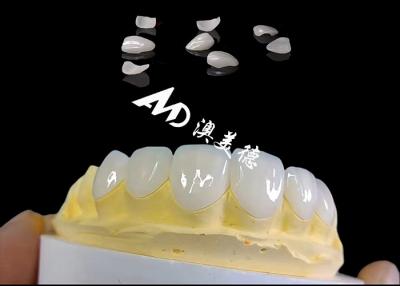 China Translucencys Ips E Max Veneers , Minimal Preparation Emax Dental Veneers for sale