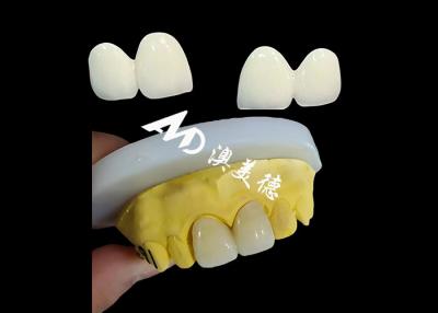 China Custom Zirconia Dental Crown Precise Fit Tooth Cap , Dental Crowns Made Of Zirconia for sale