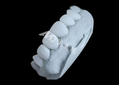 China Coronas dentales de zirconia que ofrecen una fuerza inmejorable y suavidad natural, y una translucidez natural. en venta