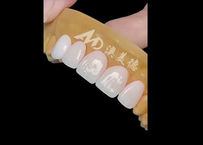 China Coroa de zircônio dental de precisão para restauração natural e duradoura à venda