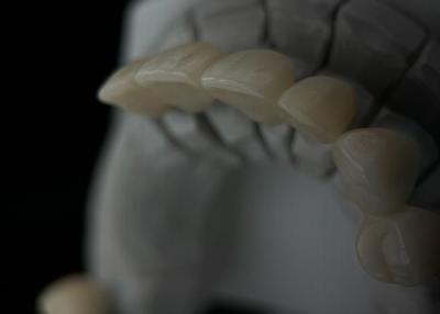 China Coroa de dente de zircônio monolítico com translucidez e resistência à venda