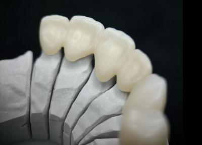 China Dental Solid Zirconia Crown Ombining Outstanding Strength And Natural Aesthetics for sale