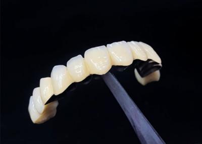 China Porcelain Fused To Metal Crown Combining Durability And Beauty For Dental Health for sale