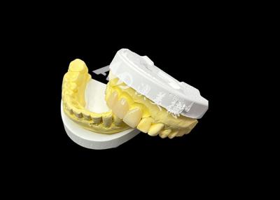 China Upgrade Your Dental Aesthetics with a Ceramic Crown Bridge that Combines Exceptional Aesthetics and Outstanding Biocompatibility for a Natural, Comfortable Smile for sale