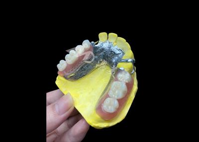 China Dentes parciais moldados ajustáveis para maior conforto e estabilidade, perfeitos para mastigar e falar à venda