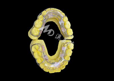 China Beagle Retainer for Effective Smile Retention and Long-Lasting Alignment for sale