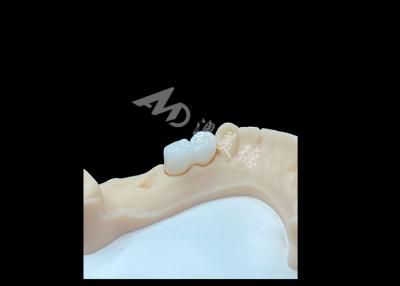 China Highly-rated Solid Zirconia Crown For Satisfying Dental Restorations for sale