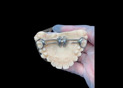 China MSE Palatal Expander Innovative Orthodontic Appliances For Effective Teeth Alignment for sale