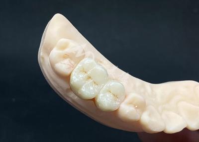 Cina Corona di zirconia ad alta traslucidità di aspetto naturale con resistenza ai frantumi in vendita