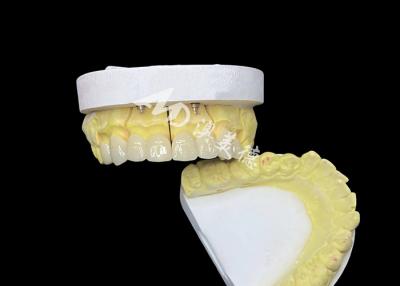 China Achieve a Perfect Smile with High Quality Ceramic Dental Crowns for Natural Appearance and Durable Strength for sale