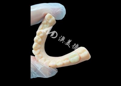 China High Strength Ceramic Zirconia Posterior Dental Crown Superior Aesthetic and Durability for sale