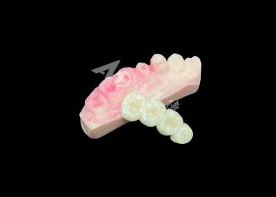 China Ponte de coroa de zircônio sólido superior para estética dental de aparência natural à venda