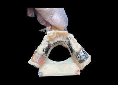 China Easy Maintenance Cast Partial Dentures for Superior Strength and Aesthetic Appeal for sale