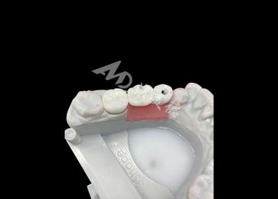 China Zirconia Dental Implant Crowns With Titanium Abutment For Enhanced Comfort And Aesthetics for sale