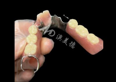 China Titantium Cast Partial Dentures With Clasps Rests Along With Teeth Set Up for sale