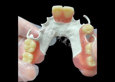 China Aesthetic Custom made Removable Partial Denture HPP Framework for Natural Partial Tooth Replacement for sale