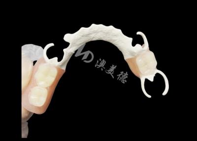 China Custom Cast Partial Denture with HPP framework for Enhanced Chewing and Speech for sale