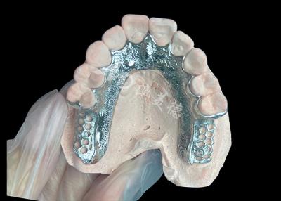 China Quadro dentário de prótese dentária parcial sem dentes configurado para estabilidade e função à venda