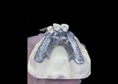 China Easy Fit Custom Cast Partial Denture Stable and Natural-looking Framework for Fast Results for sale