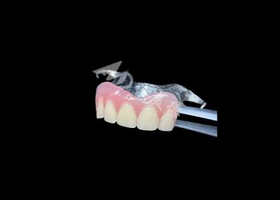 China Dentes parciais fundidos de longa duração Manutenção fácil para melhor mastigação e sorriso perfeito à venda