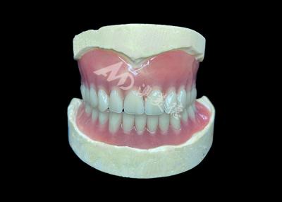 China Easy-to-Clean Custom Cast Partial Dentures Ideal for Restoring Chewing Ability and Smiles for sale