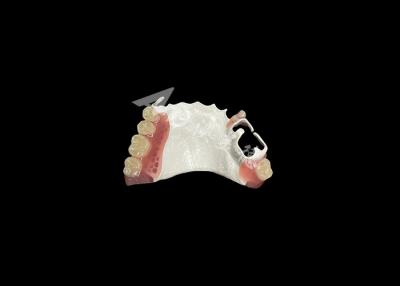 China High Quality Comfortable Partial Denture With HPP Framework Restores Chewing And Speaking Ability for sale