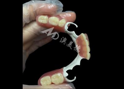 China Custom Made Durable Cast Partial Dentures With Hpp Framework For Restoring Your Smile for sale