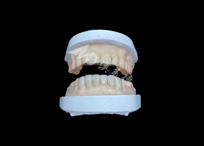 China IPS Emax Veneers Natural Looking Restorations For Esthetic Smiles for sale