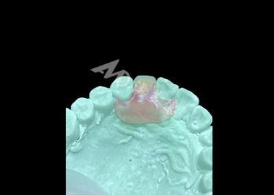 China Lightweight and Comfortable Nesbit Flexible Denture for Single Tooth Replacement for sale