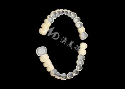 China Customized Porcelain Fused To Metal Dental Crown Bridge For Natural Smile Enhancement for sale