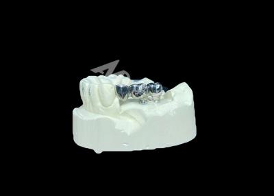 China Long-lasting Full Cast Titanium Crown Dental Implant Molar For Missing Teeth Replacement for sale