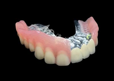 China Enhance Your Smile Natural-looking PFM Crown bridge and Removable Dentures Combo for sale