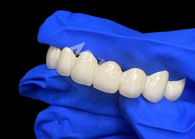 China Lava de alta translucidez Zirconia ponte dental mistura sem costura com dentes naturais à venda