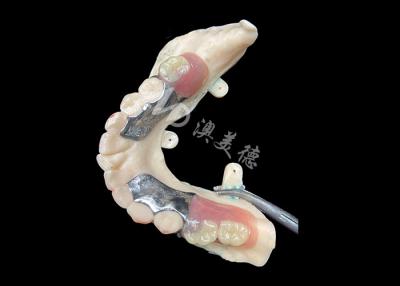 Chine Dentures partielles coulées personnalisées cadre métallique de précision pour un ajustement et une fonctionnalité optimaux à vendre