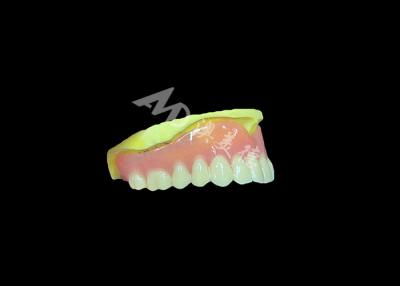 China Cast Partial Dentures Crafted for Durability Comfort and Aesthetic and Lasts Longer for sale