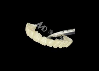 China Zirconia Dental Bridge Strong and Natural Looking Restoration for a Seamless Smile for sale