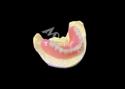 China Full acrylic Dentures Custom Removable Denture  Easy To Clean and Long-lasting for sale