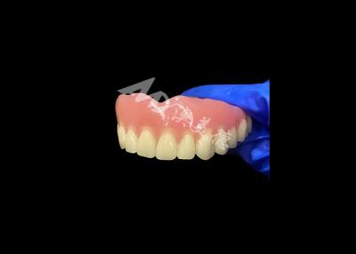 China Full Arch Acrylic Denture An Affordable Solution for International Removable Denture Needs for sale