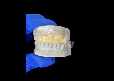 China Leichtgewicht Biokompatible 3D-gedruckte Hohlzeitbrücke für Vorimplantat-Restaurationen zu verkaufen