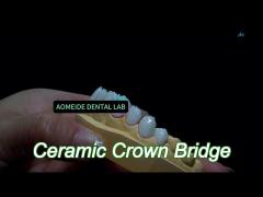 stain resistant all porcelain bridge comfortable fit for dental restoration