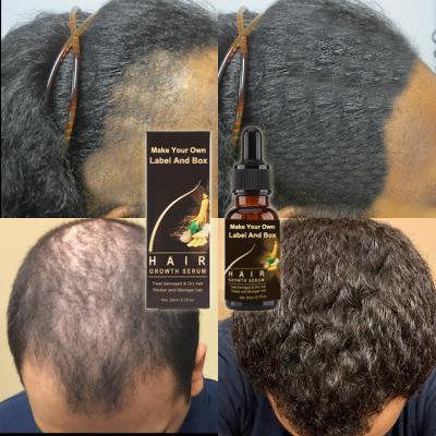 Κίνα Wholesale Natural Hair Growth Oil Serum Organic Fast Hair Growth Oil For Hair Growth Hair Growth Oil προς πώληση