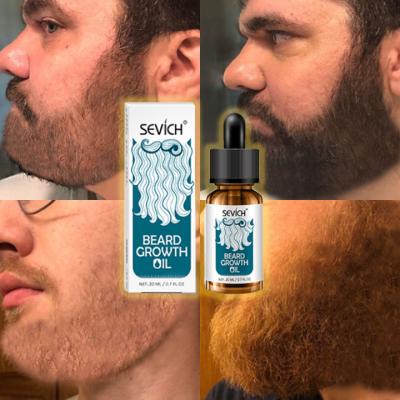 China Moisturize Best Private Label Beard Growth Oil 20ml Beard Growth Oil Beard Serum For Men for sale